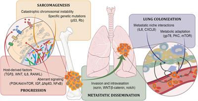 Osteosarcoma: Accelerating Progress Makes for a Hopeful Future